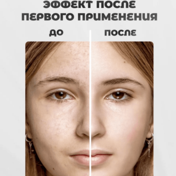 Увлажняющий алоэ-крем для лица — изображение 2