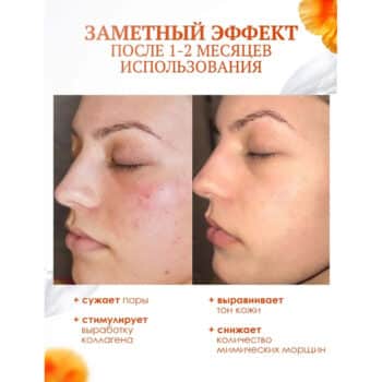 Крем для лица с ретинолом — изображение 3