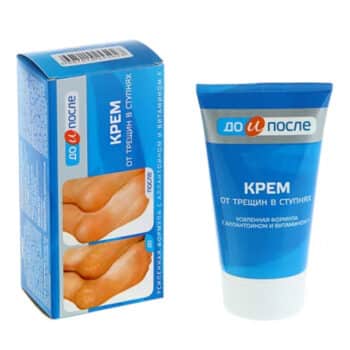 Крем от трещин в ступнях До и После 150мл — изображение 1